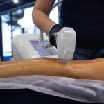 Diodlaser med tre våglängder och innovativ enhet för laserepilering: komfort och resultat utan kompromisser diodlaser-med-tre-vaglangder-och-innovativ-enhet-for-laserepilering-komfort.webp.webp
